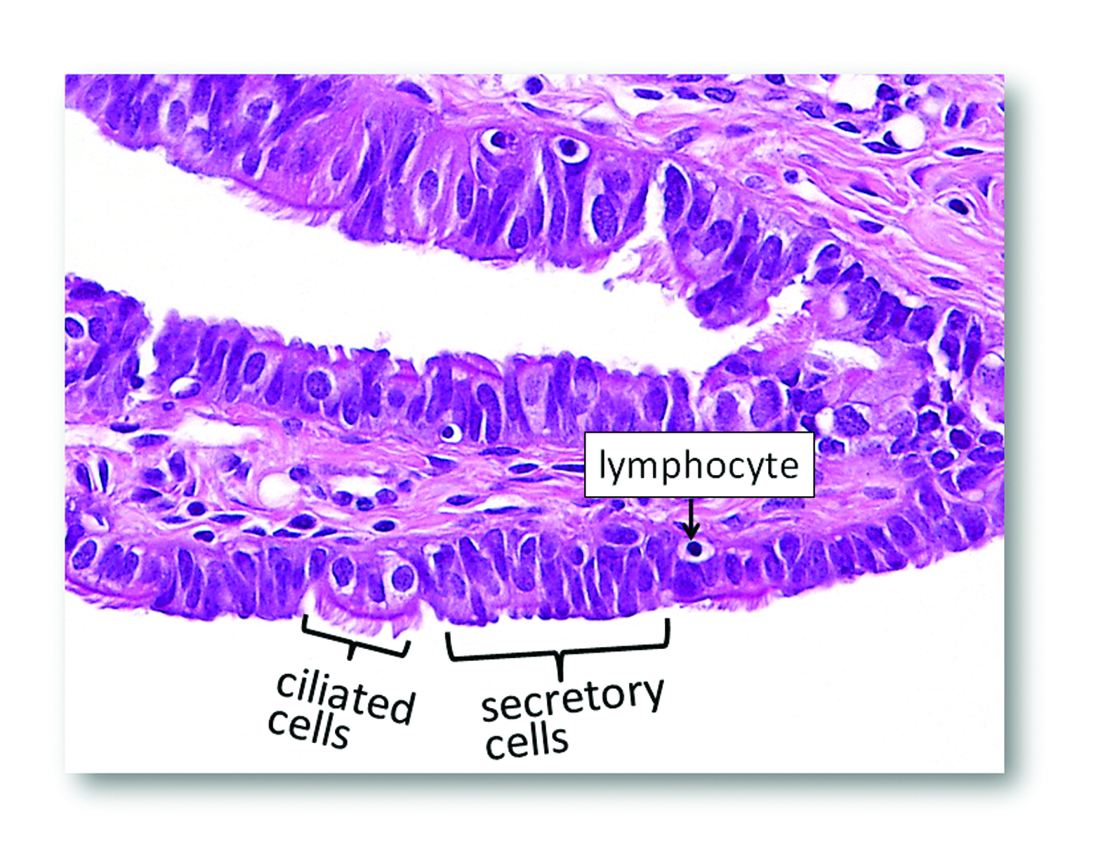 images-of-training-set-ovarian-cancer-prevention-detection-and-treatment